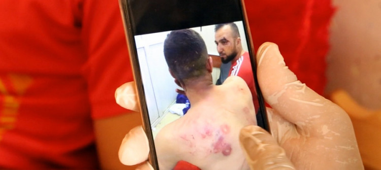 ركل ولكم وضرب بمقابض الأسلحة..<br> تفاصيل مشاجرة اندلعت بين مجموعة من الشبان وابن رئيس محكمة كركوك