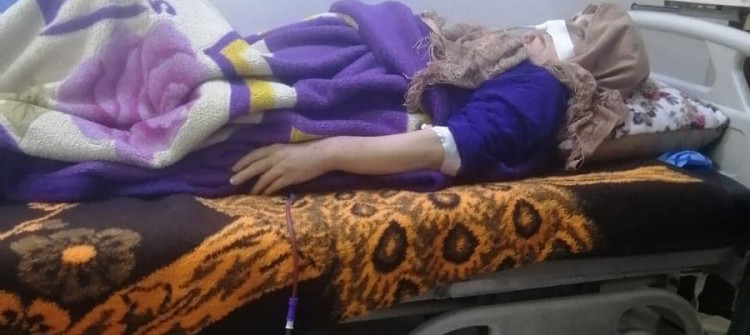العثور على مقص ببطن امرأة بعد 35 يوم من إجراء عملية جراحية