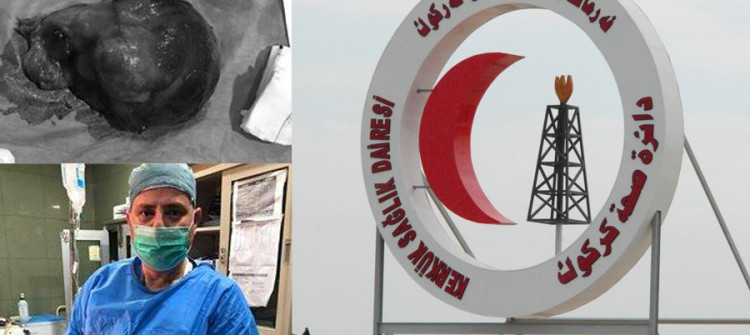 سێیەم نەشتەرگەری تایبەت و دەگمەن لە كەركوك <br>"گرێیەكی گەورە" لە گورچیلەی نەخۆشێكی 88 ساڵ دەرهێنرا