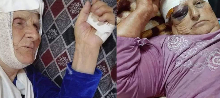تفاصيل الهجوم على مواطنتين مسيحيتين في ناحية برطلة